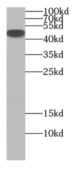 SGCB Rabbit Polyclonal Antibody
