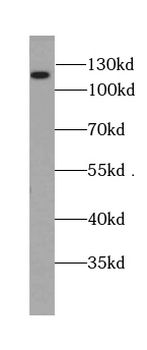 BRD8 Mouse Monoclonal Antibody