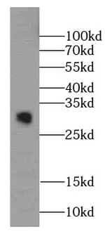 SDHAF2 Rabbit Polyclonal Antibody