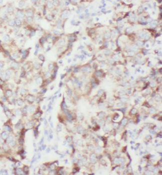 MZT1 Rabbit Polyclonal Antibody