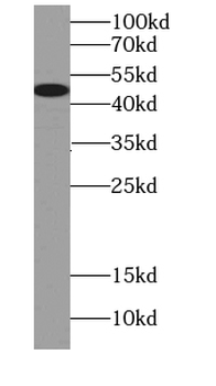 VIPAS39 Rabbit Polyclonal Antibody