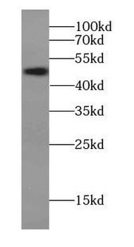 VCPKMT Rabbit Polyclonal Antibody