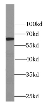 CTU2 Rabbit Polyclonal Antibody