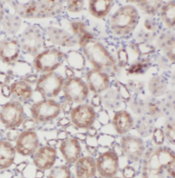 CTU2 Rabbit Polyclonal Antibody