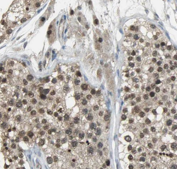 IZUMO4 Rabbit Polyclonal Antibody