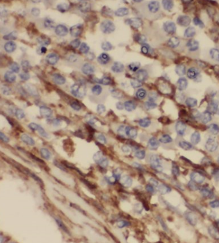 BRK1 Rabbit Polyclonal Antibody