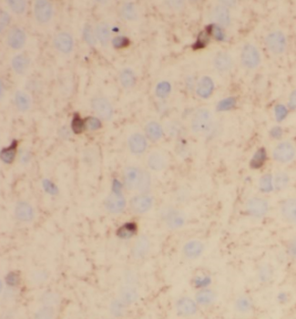 C9orf72 Antibody
