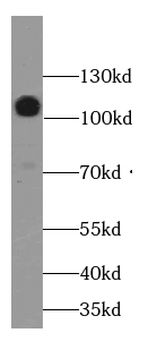 CDH13 Rabbit Polyclonal Antibody