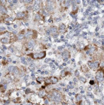 CDH13 Rabbit Polyclonal Antibody