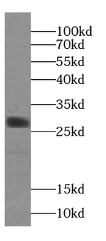 CAPNS2 Rabbit Polyclonal Antibody