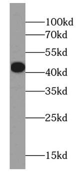 CAPG Specific Rabbit Polyclonal Antibody