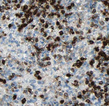 CAPG Specific Rabbit Polyclonal Antibody