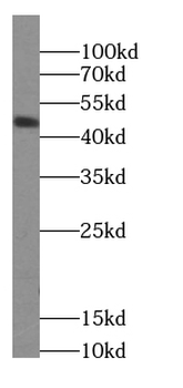 CSNK1D Rabbit Polyclonal Antibody