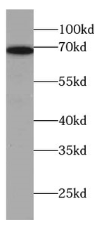 SLC7A1 Rabbit Polyclonal Antibody