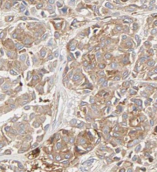 SLC7A1 Rabbit Polyclonal Antibody