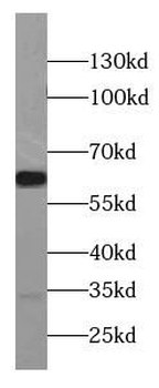 CCKBR specific Rabbit Polyclonal Antibody