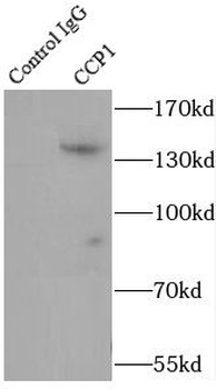 AGTPBP1 Rabbit Polyclonal Antibody