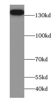AGTPBP1 Rabbit Polyclonal Antibody