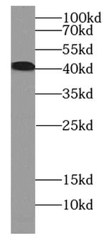CCR2 Antibody