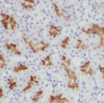 CCR2 Antibody