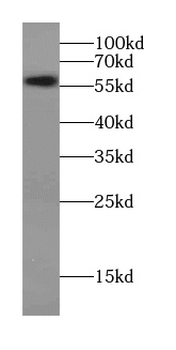 CCT6A Specific Rabbit Polyclonal Antibody