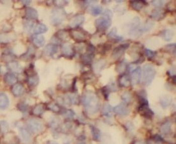 CD3G Antibody