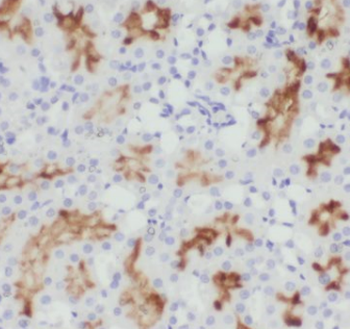 CHST13 Antibody