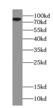 SH3KBP1 Rabbit Polyclonal Antibody