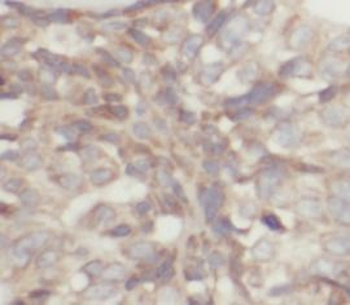 CLDN4 specific Rabbit Polyclonal Antibody
