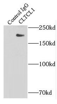 CLTCL1 Rabbit Polyclonal Antibody