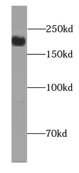 CLTCL1 Rabbit Polyclonal Antibody