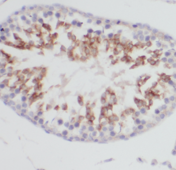 CLTCL1 Rabbit Polyclonal Antibody