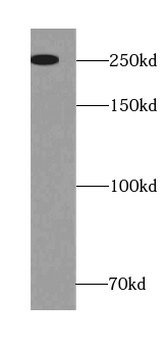 NCAPD2 Rabbit Polyclonal Antibody