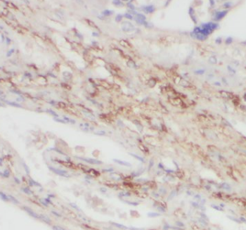NCAPD2 Rabbit Polyclonal Antibody