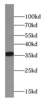 CNN2 Mouse Monoclonal Antibody