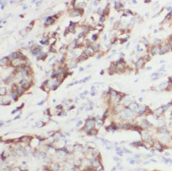 CNN2 Mouse Monoclonal Antibody