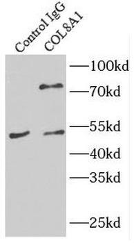 COL8A1 Antibody