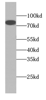 COL8A1 Antibody