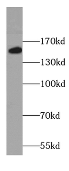 COL16A1 Rabbit Polyclonal Antibody