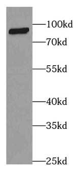 CFB Antibody