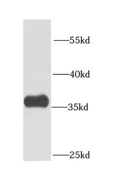 CPOX Rabbit Polyclonal Antibody