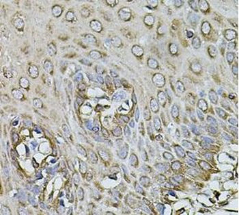 CPOX Rabbit Polyclonal Antibody