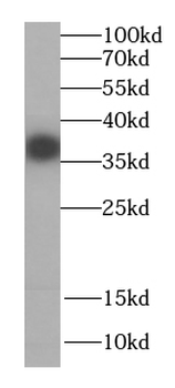CPOX Rabbit Polyclonal Antibody