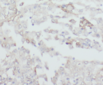 CPOX Rabbit Polyclonal Antibody