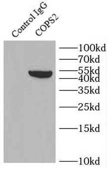 COPS2 Rabbit Polyclonal Antibody