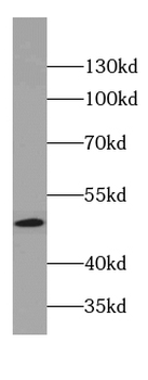COPS2 Rabbit Polyclonal Antibody