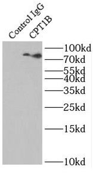CPT1B Antibody