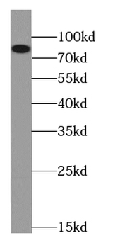 CPT1B Antibody