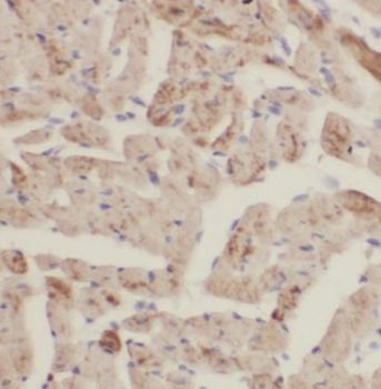CPT1B Antibody