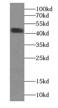 Creatine Kinase MM Specific Rabbit Polyclonal Antibody